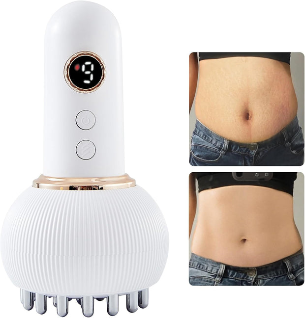Lymphatic Drainage Massager – Reduce Cellulite & Stretch Marks